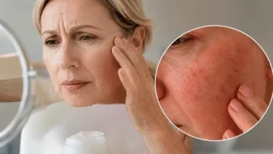 عوارض کرم ضد چروک چیست