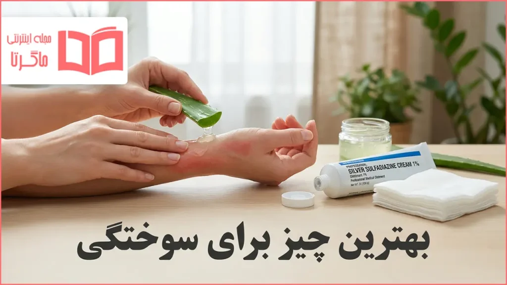بهترین چیز برای سوختگی