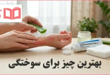بهترین چیز برای سوختگی