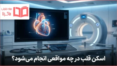 اسکن قلب در چه مواقعی انجام می شود