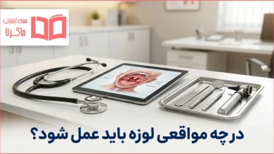 در چه مواقعی لوزه باید عمل شود