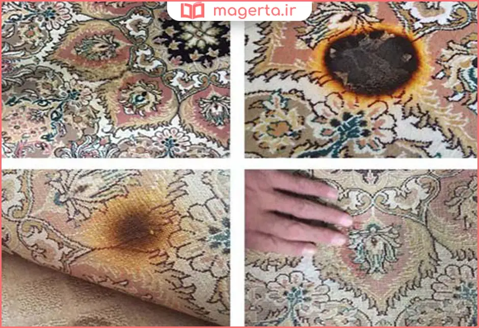 ترمیم سوختگی با قابلمه داغ