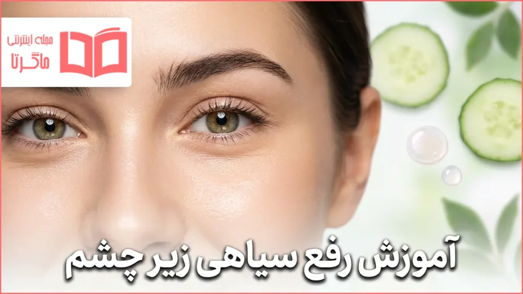 آموزش رفع سیاهی زیر چشم