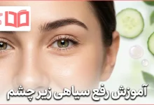 آموزش رفع سیاهی زیر چشم