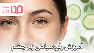 آموزش رفع سیاهی زیر چشم
