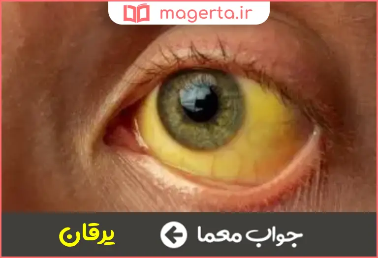 جواب معما زردی در جدول